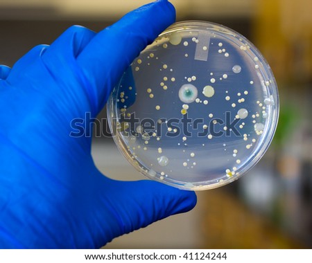 The microorganisms on a petri plate that grew from a person's sneeze.