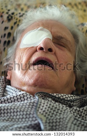 ill person with eye bandage just after eye operation