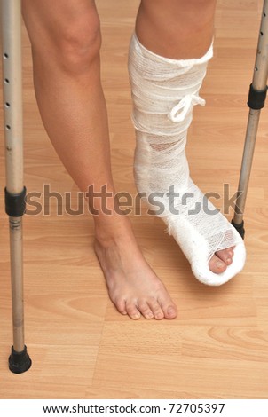 Patient with broken leg in cast and bandage
