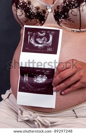 Pregnant woman holding ultrasound result