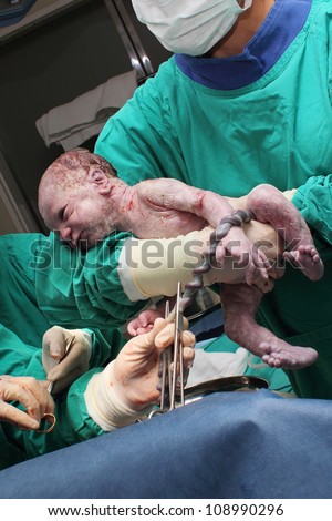 A doctor holds a new born baby whilst another doctor cuts the Umbilical cord.