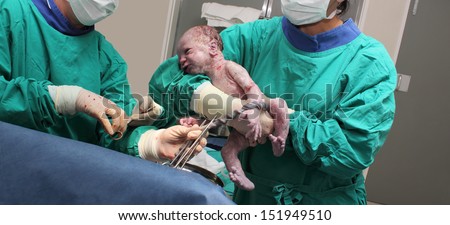A doctor holds a new born baby whilst another doctor cuts the Umbilical cord.