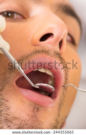 closeup portrait of young handsome man at the dentist with mouth open