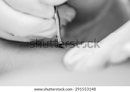 Closeup of tattoo needle working on skin black and white edition