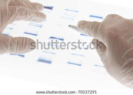 Researcher examining DNA sequence transparency slide