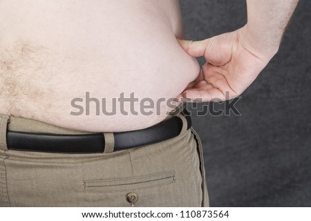 Stomach Of An Obese Man