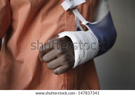 Closeup Midsection Of A Man With Broken Arm In Cast