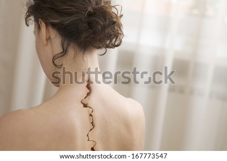 Back view of woman with crack on back