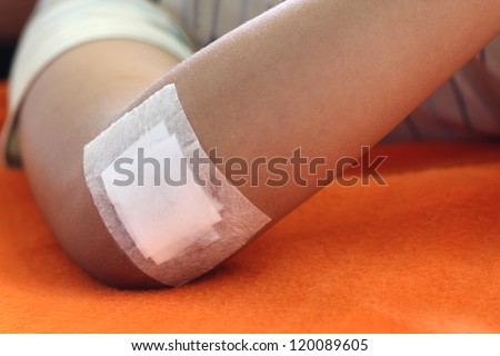Wound sealed with plaster