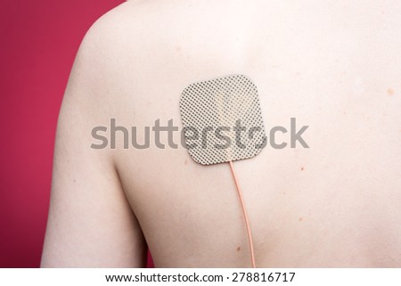 A neurostimulation electrode for Transcutaneous Electrical Nerve Stimulation (TENS therapy), on  a woman's back. Photographed with studio lighting in front of a red backdrop.