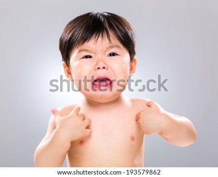 Crying baby with scratching his body