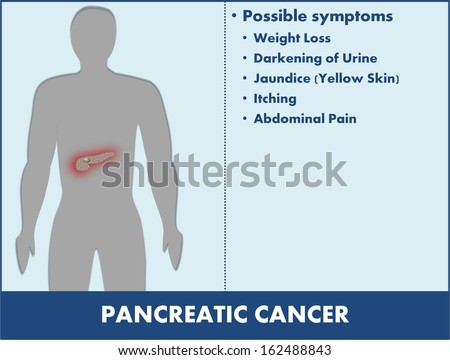 Pancreatic cancer disease information