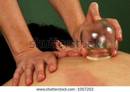 Cupping Gua-Sha at Spa Mind and Body Boutique  Relaxing and detoxification treatment