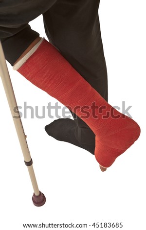 broken leg clipart. stock photo : Broken leg