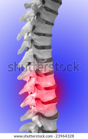 Human Spinal-column, showing red for pain