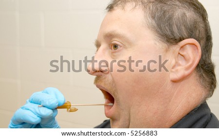 Swabbing a suspects mouth for DNA evidence.