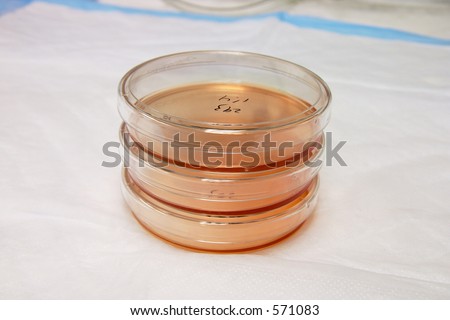 Stack of 3 petri dishes (tissue culture plates) with writing, in a horizontal frame with copy space.