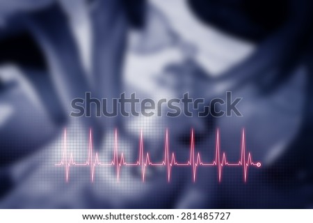 Cardiopulmonary resuscitation (CPR). Cardiogram concept. Background.