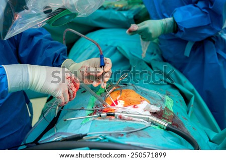 Surgeons working on a patient in a operating theater