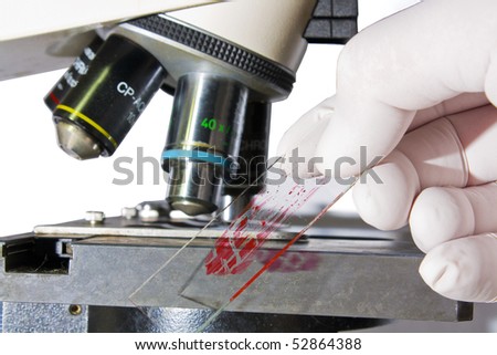 Hand with latex examination glove placing blood sample under microscope in laboratory isolated on white background medical and cancer research concept