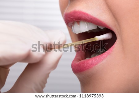 Dentist\'s Hand Taking Saliva Test From Woman\'s Mouth With Cotton Swab