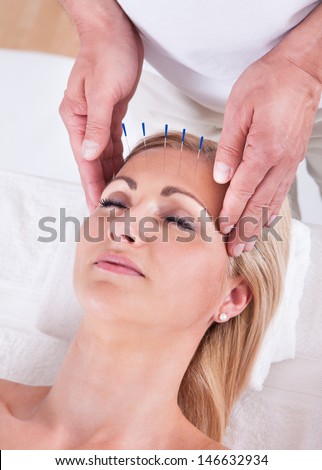 Detail Of A Woman  Receiving An Acupuncture Needle Therapy