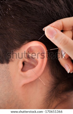 Close-up Of A Acupuncturist Holding Needle Near Ear