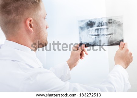 Doctor studying an x-ray film holding it up to the light as he makes his diagnosis or checks on the progress of treatment