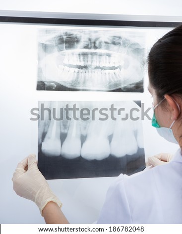 Female dentist examining dental Xray in clinic