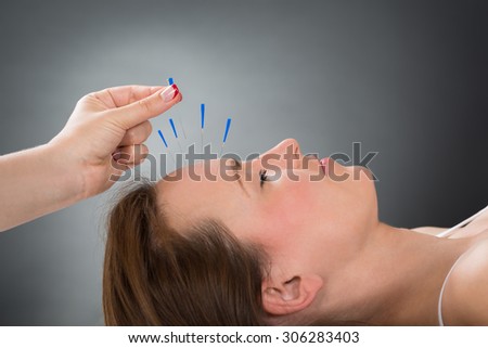 Close-up Person Hands Putting Acupuncture Needle On Face Of Young Woman