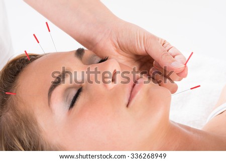Closeup of hand performing acupuncture therapy on head and chin at salon