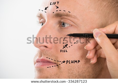 Close-up Of A Man\'s Face With Correction Line Drawn By Person\'s Hand For Plastic Surgery