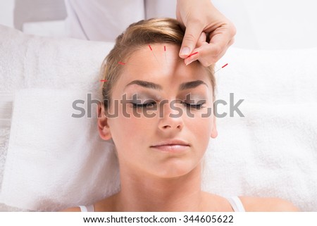 Closeup of hand performing acupuncture therapy on patient\'s head at salon