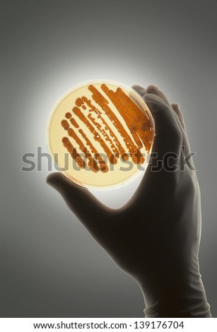 Petrie dish with bacteria in growth medium used for biological research and discovery
