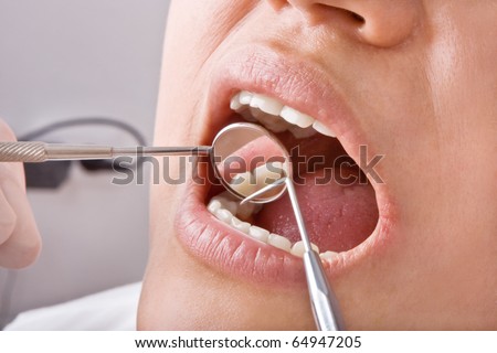 Close-up mouth examination by dentist.