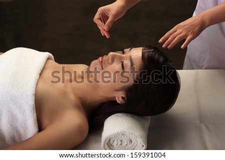 Doctor putting acupuncture needles on woman\'s head,close-up