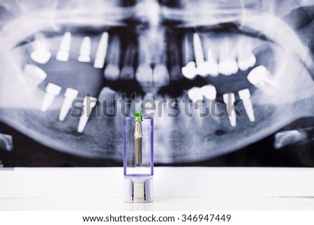 Dental Implant and tooth radiography as baground