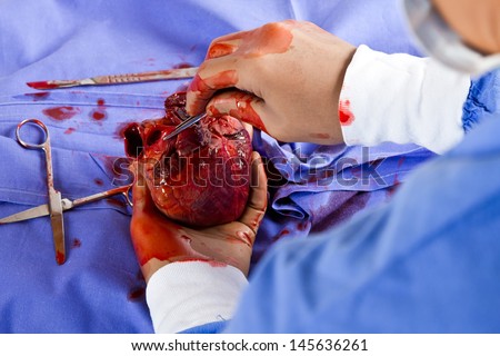 Doctor operating on patient heart in blue with tools