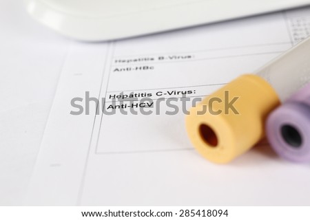 Laboratory test, Hepatitis C, blood tubes on paper