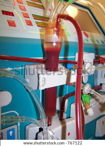 venous bubble trap of hemo dialysis monitor
