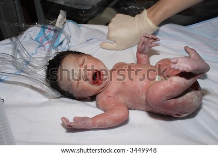 Newborn baby in a hospital bassenette having vitals checked right after birth