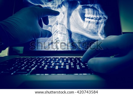 Doctor Examining Spine and Head X Ray Scan Images on His Laptop Computer. Medical Application for X-Ray Display and Examination. Radiology Theme.