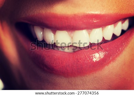 Close up on woman white teeth.