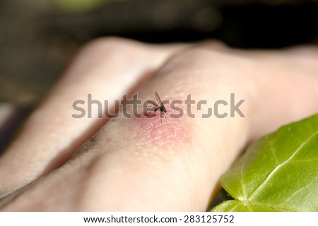 Mosquito biting human finger. Macro shot selective focus on mosquito.Red inflammation around bite. Green leaf next to finger.