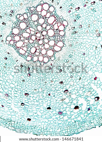 Cross section of a portion of the root of elderberry (Sambucus).  Magnification 100x