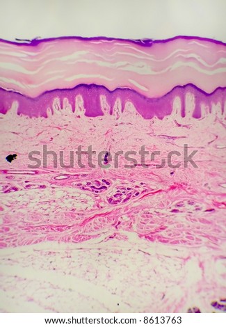 Skin cross section showing the sweat glands and the surrounding tissue.