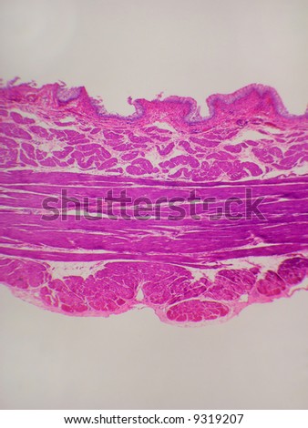 Bladder tissue cross section