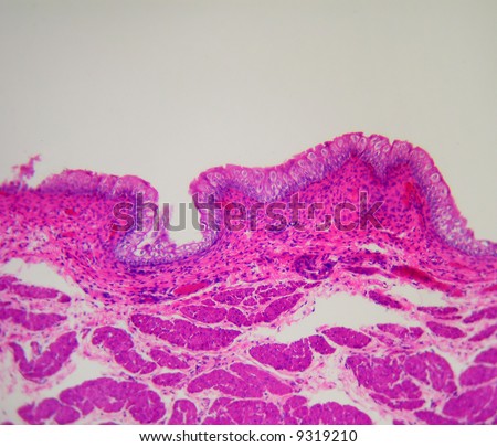 bladder tissue cross section