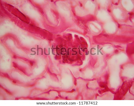 Microscopic educational--High power view of a kidney glomerulus.