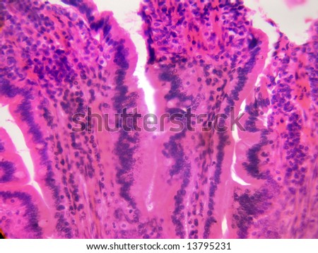 Stomach Tissue